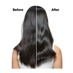 SE Scalp Advanced Anti Dandruff Shampoo 1500ml Loreal Professional-loreal uae-al basel cosmetics