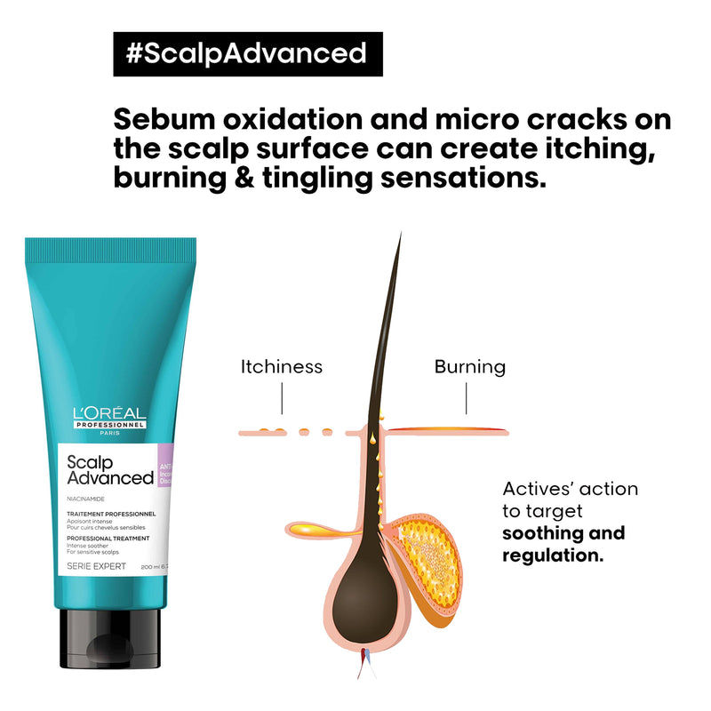 SE Scalp Advanced Anti Discomfort Treatment 200ml Loreal Professional - loreal uae- al basel cosmetics